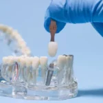 Mennyit keres egy fogtechnikus?